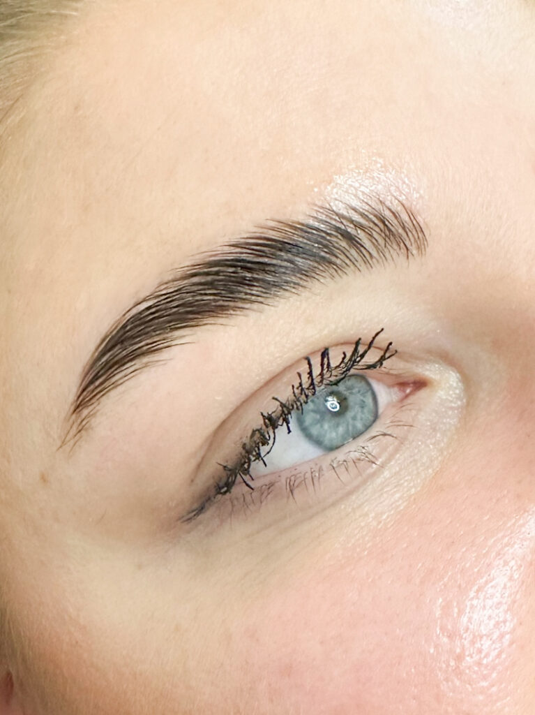 luonnollinen kulmien kohotus