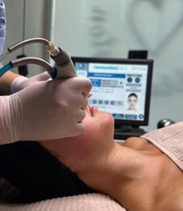 hydrafacial - puhdas iho