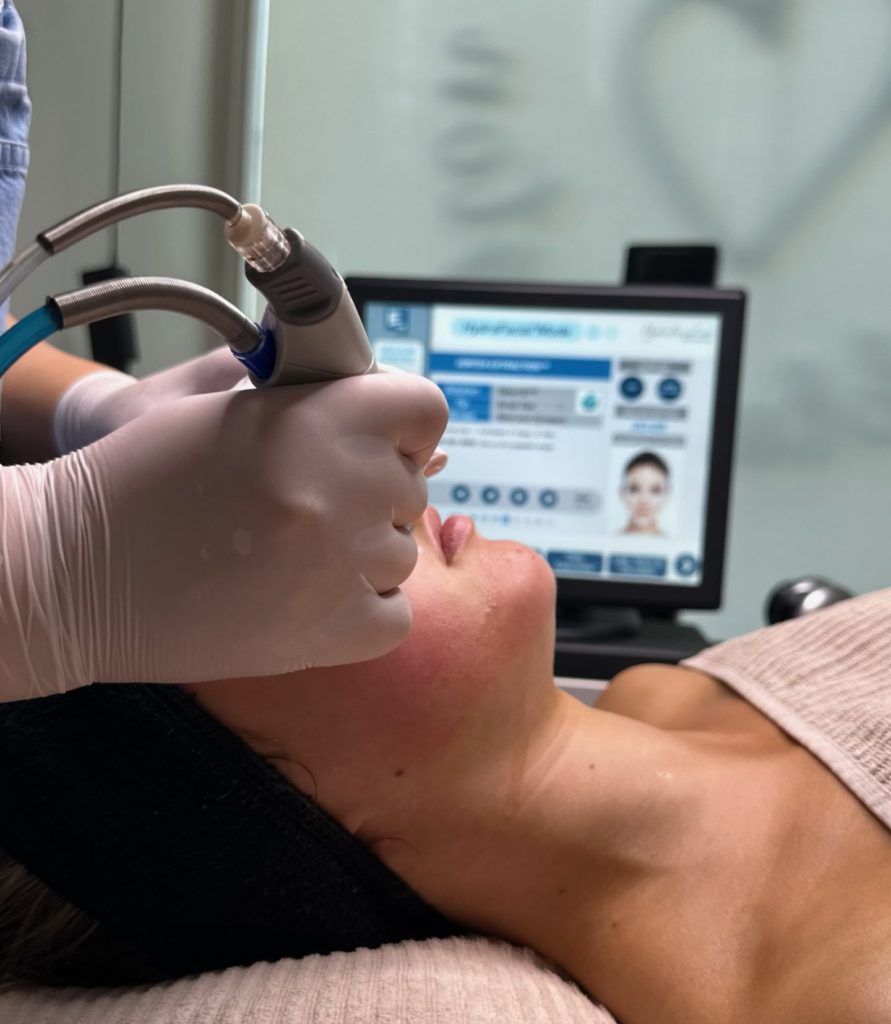 hydrafacial - puhdas iho
